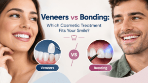 Veneers vs bonding comparison showing cosmetic dental treatments for improving a smile.